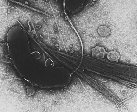 Cholerae bacterium: Vibrio cholerae