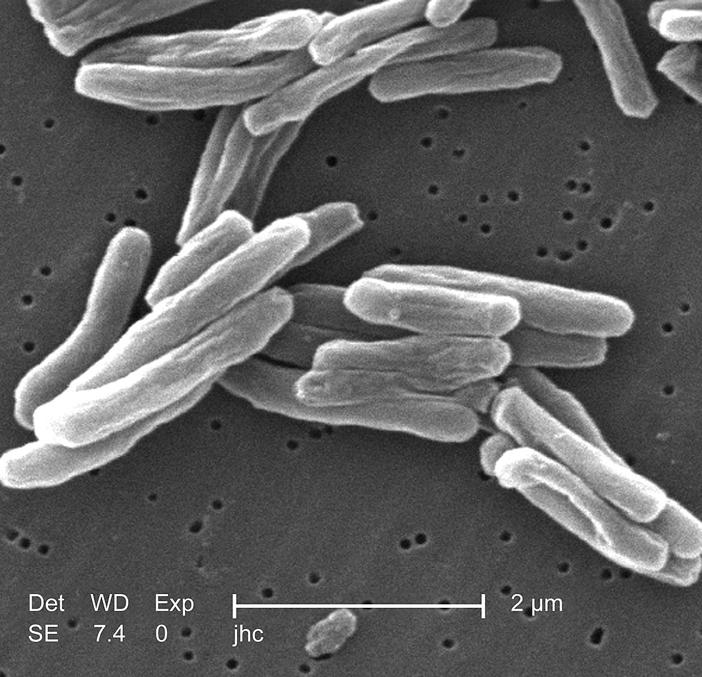 Tuberculosis bacterium: Mycobacterium tuberculosis